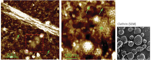 iIntra-cellular-cytoskeleton-and-clathrin-coated-pits-Image